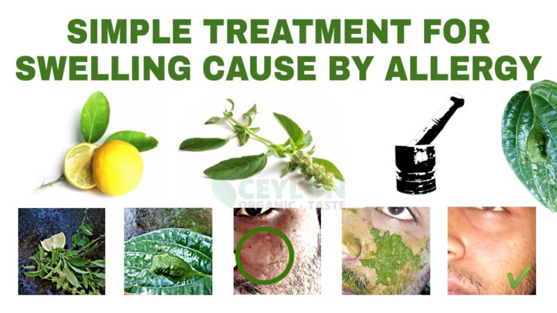 Simple Treatment for swelling caused by allergy